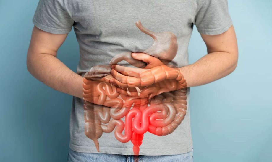 أعراض سرطان الأمعاء وأسبابه