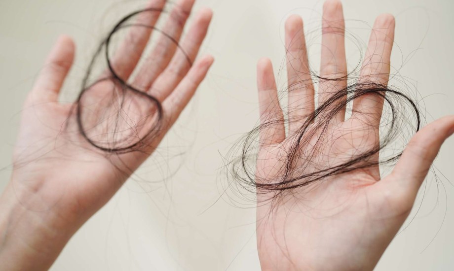 أسباب تساقط الشعر في الخريف