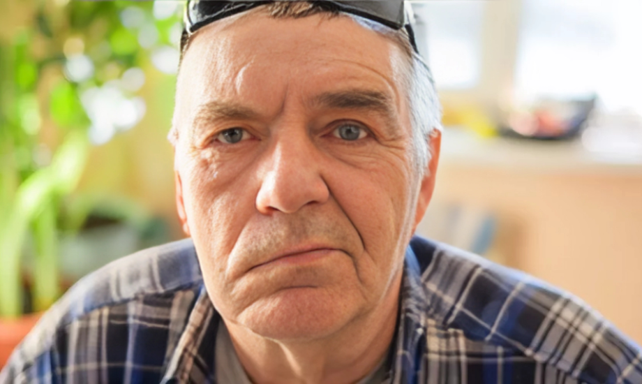 علاج شلل الوجه النصفي