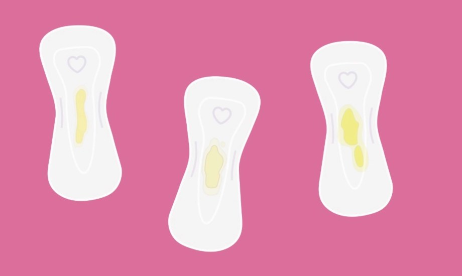 أسباب الإفرازات الصفراء