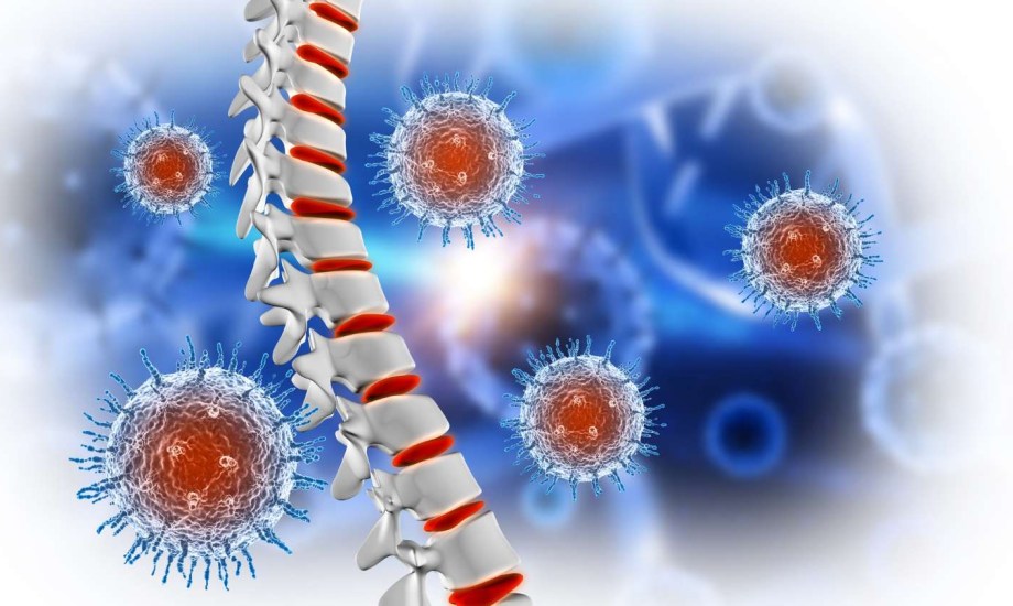 دليلك الغذائي لمكافحة هشاشة العظام