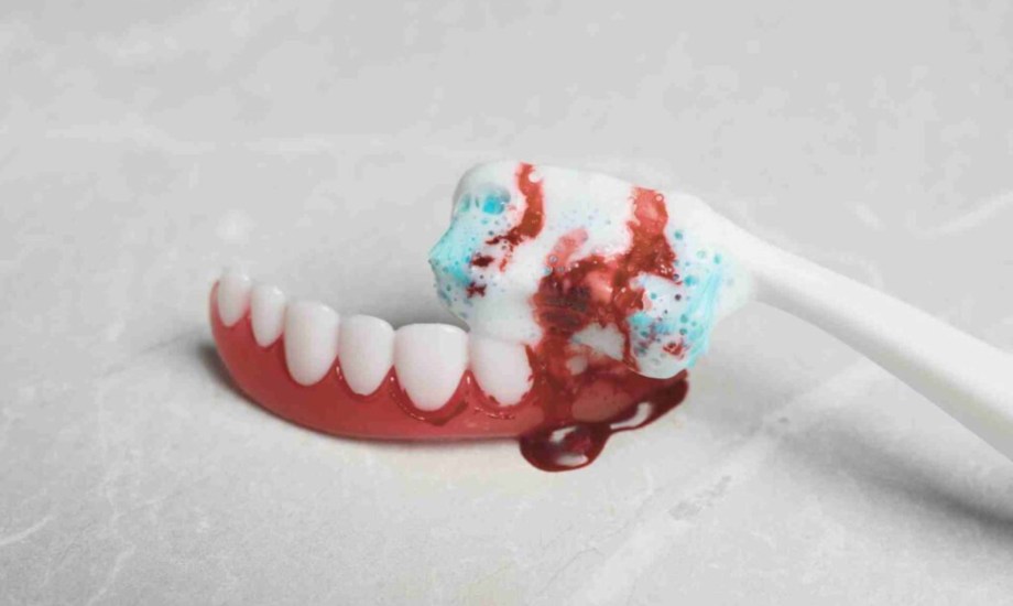 أسباب خروج الدم من الفم في الصباح