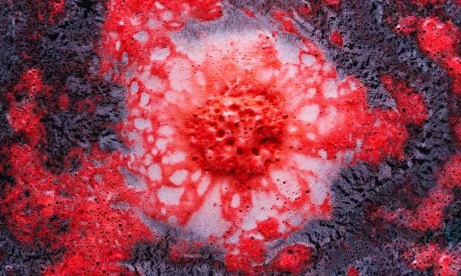 فيروس ماربورغ يتفشى في دولة إفريقية