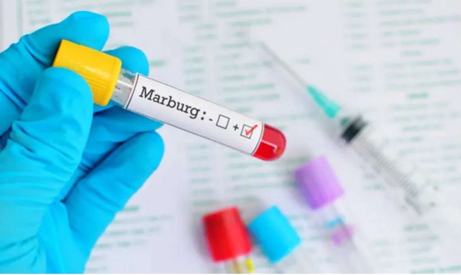 عوامل تزيد خطر الإصابة بفيروس ماربورغ