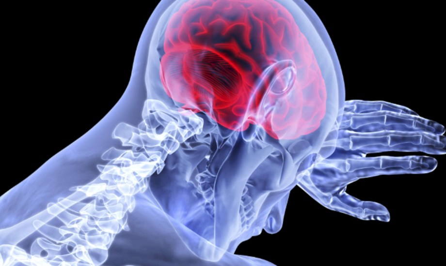 علامات تدل على التعافي من السكتة الدماغية