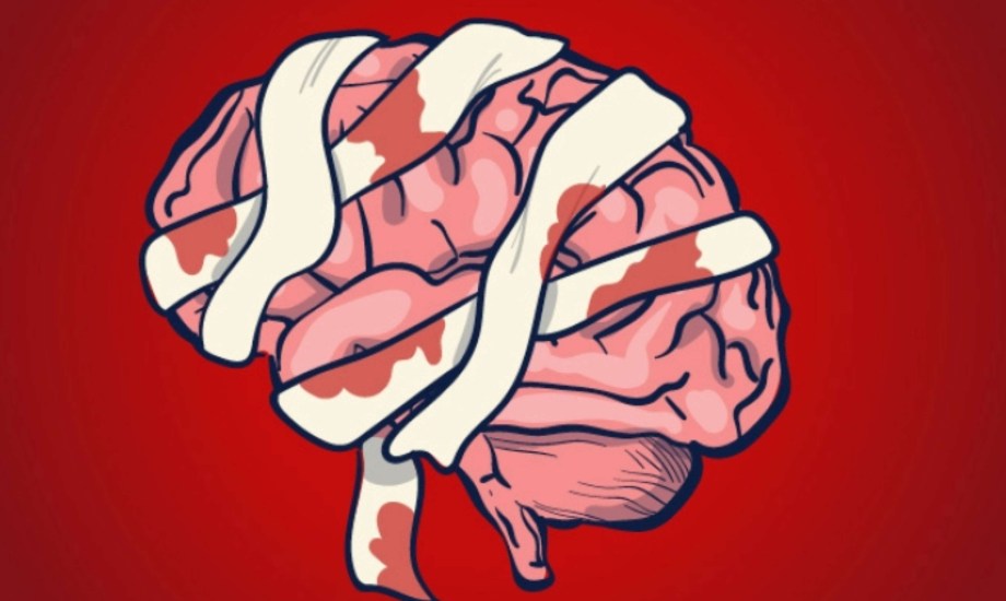 أعراض إصابات الدماغ الرضحية