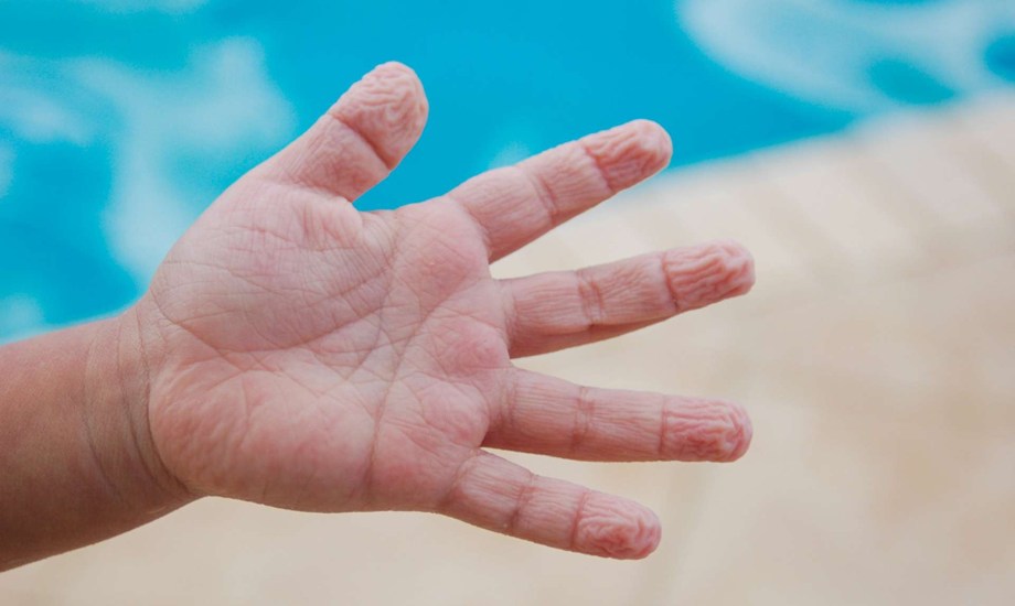 أسباب وأعراض تورم الأصابع في الشتاء