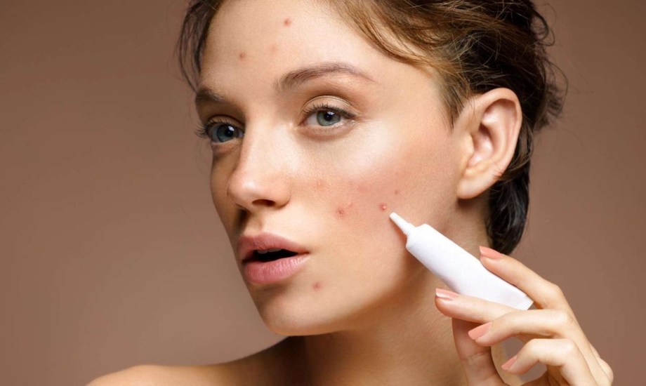 علاجات لحب الشباب تسبب السرطان