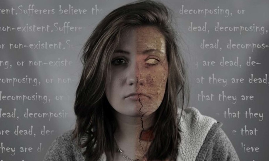 أسباب الإصابة بمتلازمة كوتار