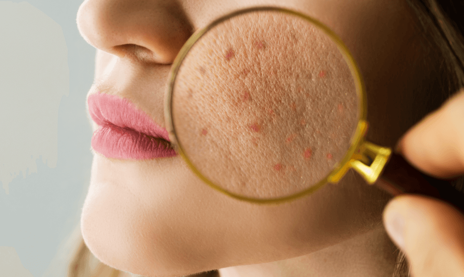 أخطاء تهدد صحة البشرة