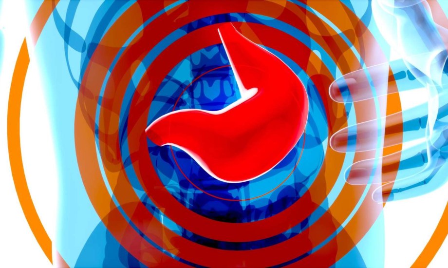 دواء جديد لعلاج سرطان المعدة المتقدم