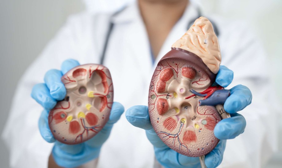 كيف تعرف أنك مصاب بالتكيسات الكلوية؟
