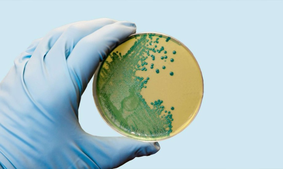 مرض الليستريا.. أسبابه وأعراضه والفئات الأكثر عرضة