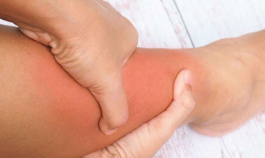 الفئات الأكثر عرضة لالتهاب النسيج الخلوي