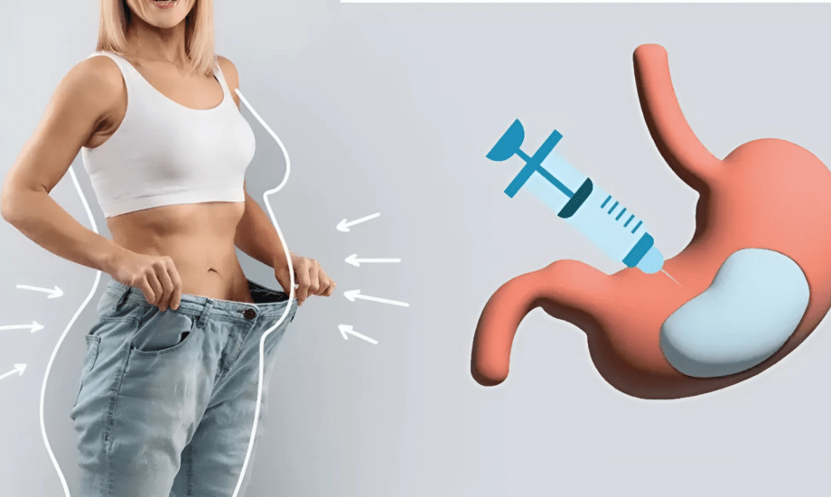 بوتوكس المعدة لفقدان الوزن