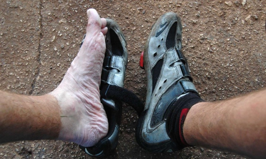 أسباب مرض قدم الخندق