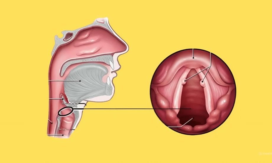 أعراض عقيدات الأحبال الصوتية وطرق الوقاية