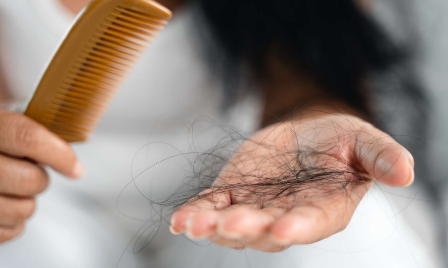 5 مشروبات على الريق لمكافحة تساقط الشعر