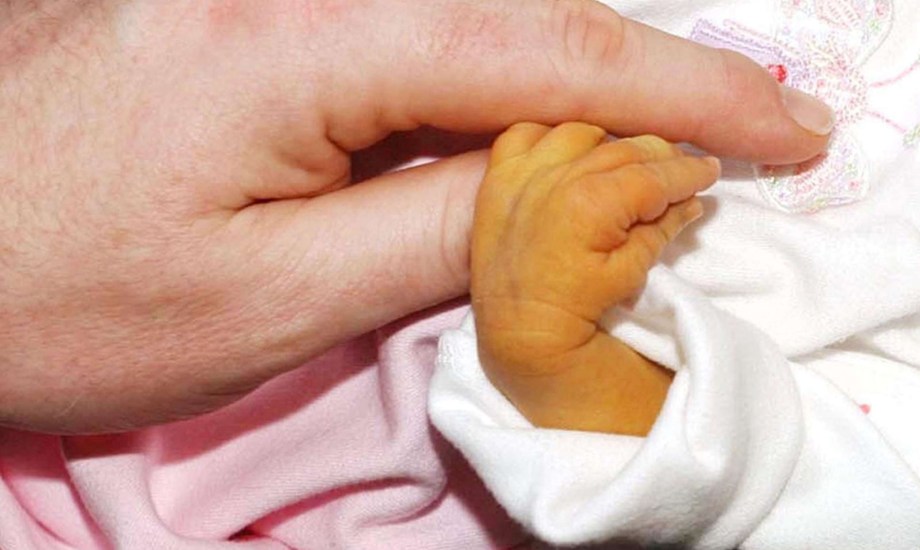 أسباب اليرقان عند حديثي الولادة