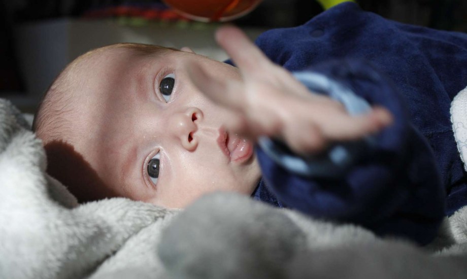 كل ما تحتاج معرفته عن اليرقان لدى الرضع