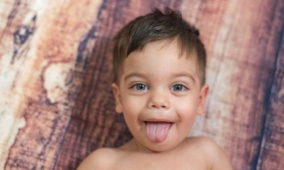 مرض القلاع الفموي