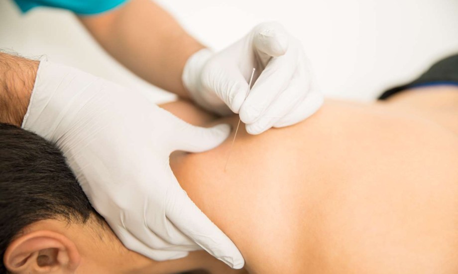 أفضل مراكز للعلاج بالإبر الصينية في السعودية والإمارات