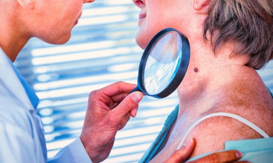 تقنيات حديثة لإزالة سرطان الخلايا القاعدية