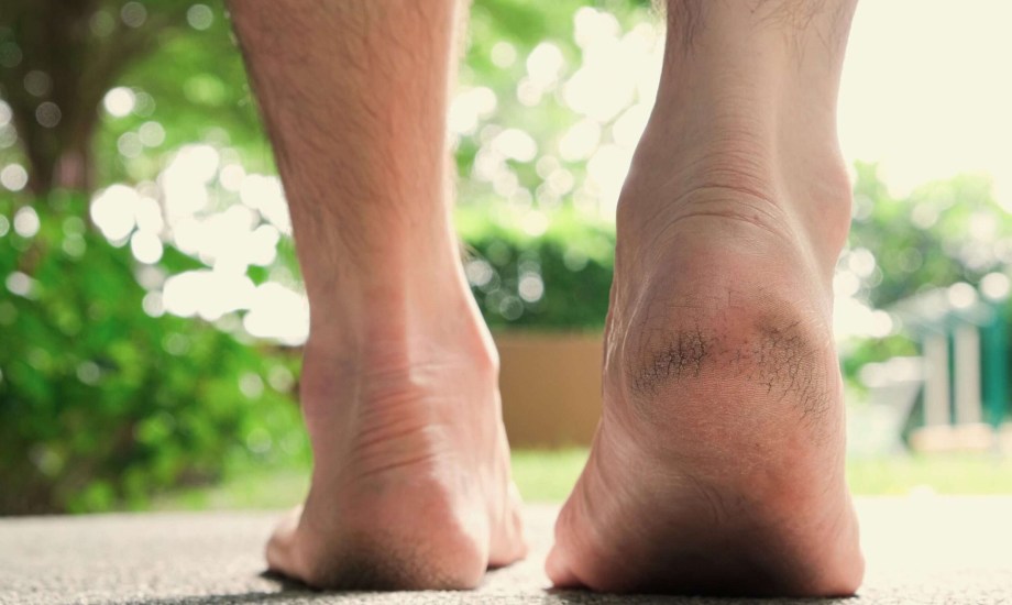 أسباب وأعراض تشققات الجلد