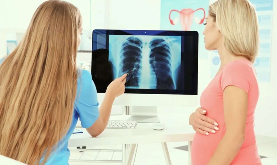  خطورة الأشعة السينية على المرأة الحامل