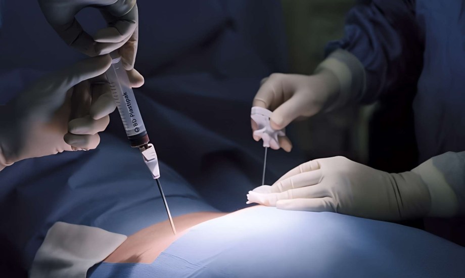 الدول الرائدة في زراعة نخاع العظم