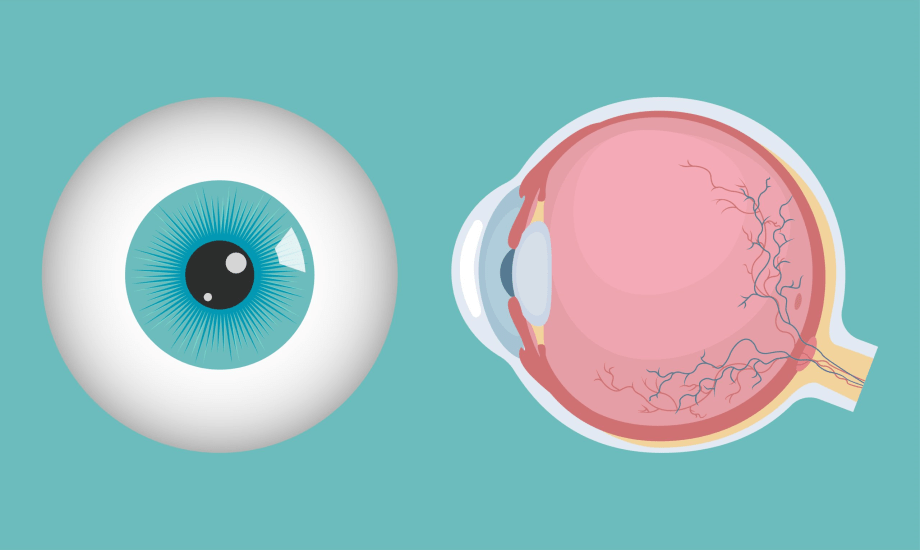 أسباب الإصابة باعتلال الشبكية السكري