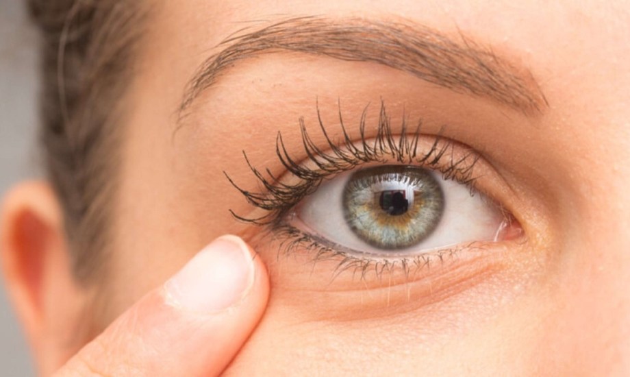 4 طرق لعلاج  جفاف البشرة حول العين