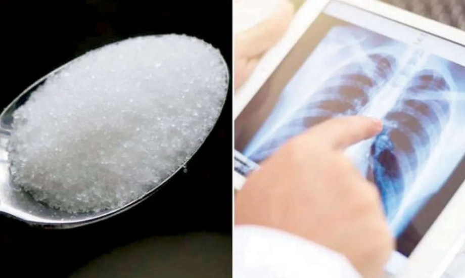 كيف يؤثر السكر على صحة الرئتين؟