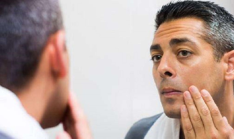 أسباب فرط التصبغ عند الرجال