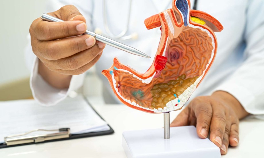 تمزق المرارة.. 7 أسباب للإصابة وأعراض ومضاعفات لا تتجاهلها