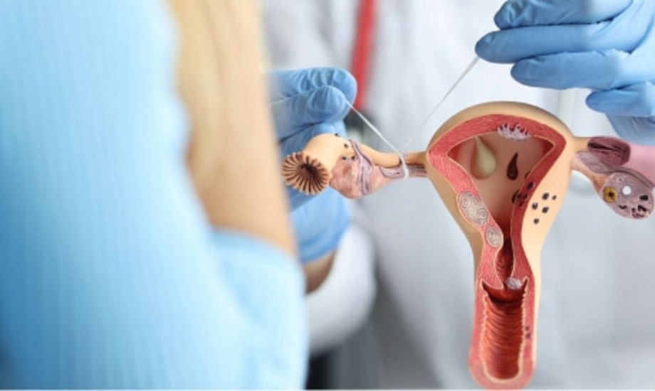 أسباب وعوامل خطر التهاب قناة فالوب