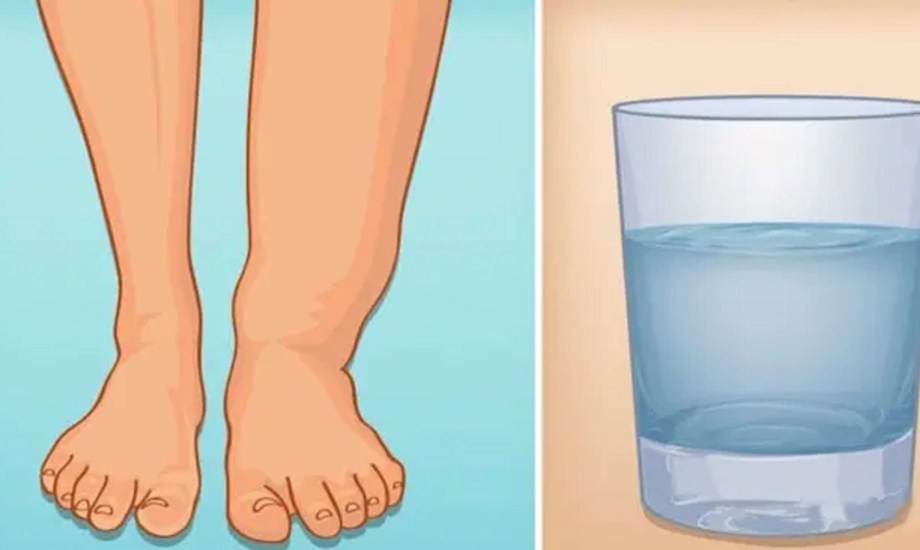 عوامل تزيد خطر احتباس السوائل في الجسم