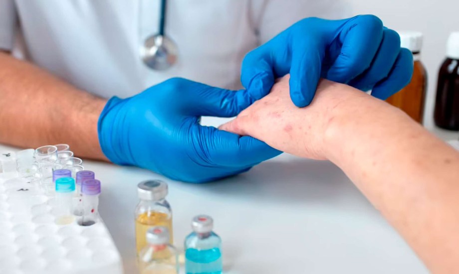 أمراض جلدية شائعة لدى مرضى السكري