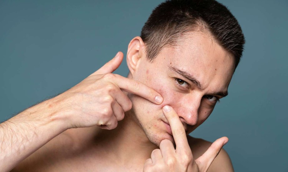 الطفح الجلدي عند الرجال