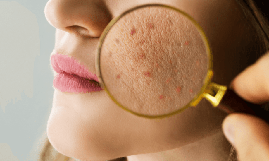 أسباب تضرر حاجز البشرة