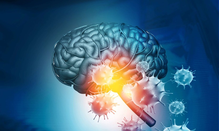 أسباب وأعراض التهاب الدماغ المناعي الذاتي