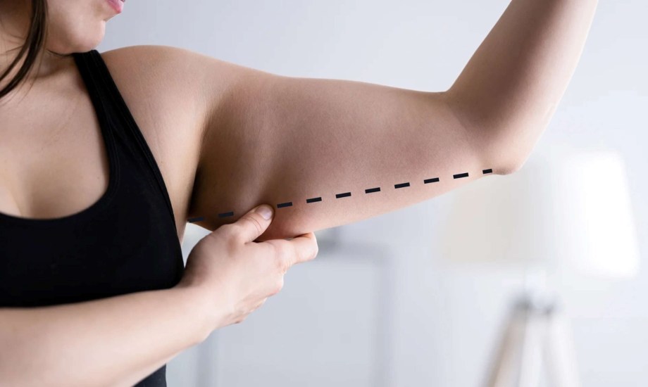 الفوائد والمخاطر المحتملة لعملية شد الذراعين