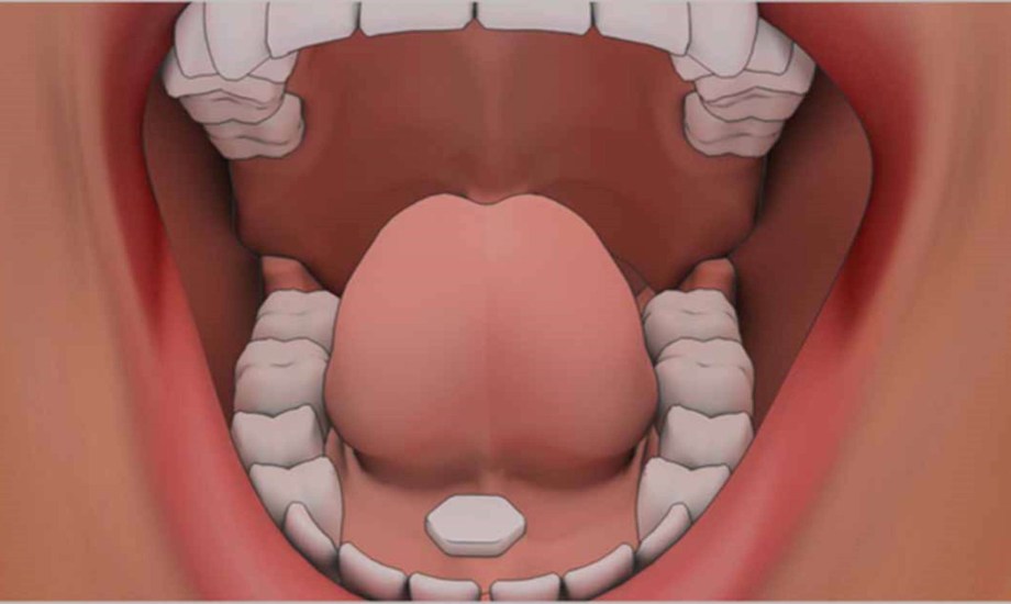 فوائد الأدوية تحت اللسان وكيفية تناولها 