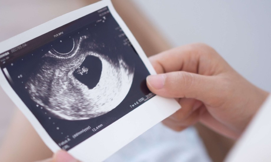 هل تشعرين بخيبة أمل بسبب جنس الجنين؟