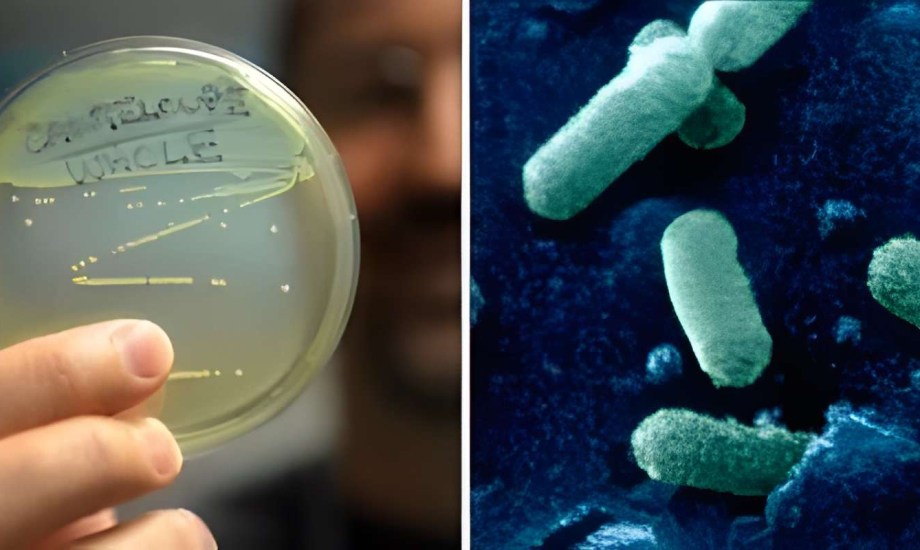 أسباب تفشي الليستيريا في أمريكا