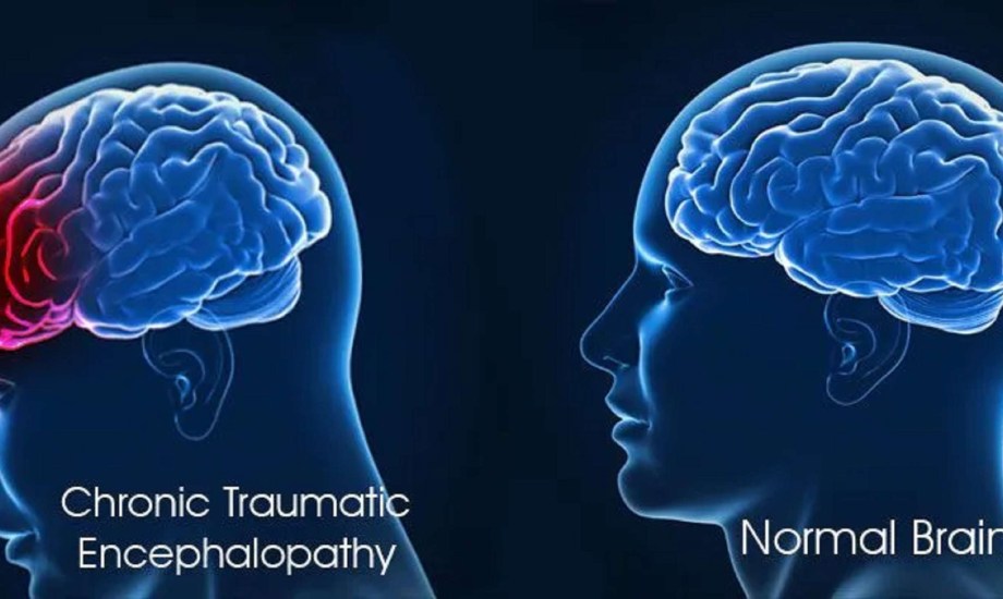 أسباب وأنواع اعتلال الدماغ الأيضي