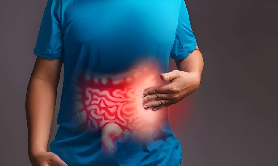 أنظمة غذائية  لالتهاب الأمعاء