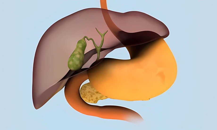 أسباب سرطان القنوات الصفراوية وأعراضه وطرق الوقاية