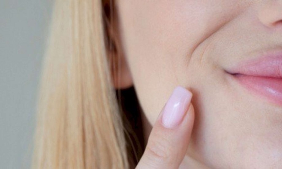 4 طرق للوقاية من التصبغات حول الفم