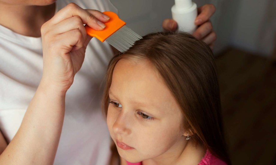 هل الملح آمن للتخلص من قمل الرأس؟